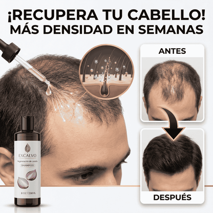 EXCALVO💆‍♂️ shampoo nutricional de cebolla🧅 canela y gengibre 🌿