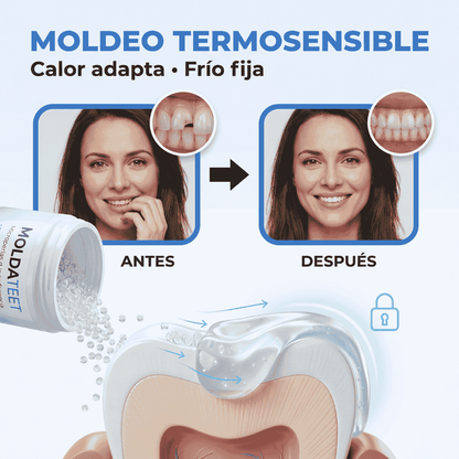 EliteSmile: Kit de Reconstrucción Dental Profesional